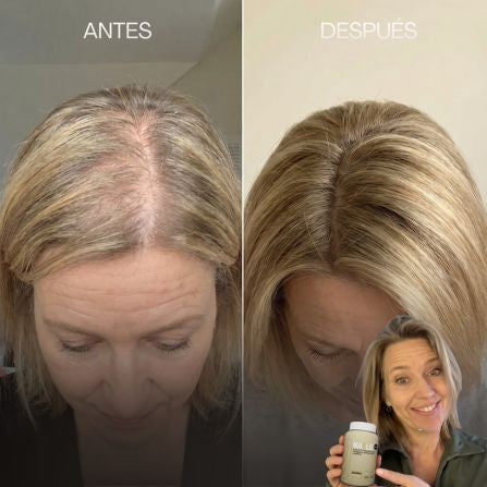 Detén la Caída del Pelo y las Uñas Rotasdesde dentro