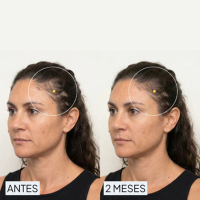 María L., 32